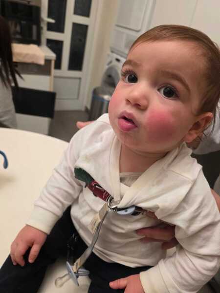 Does this look like exzema?