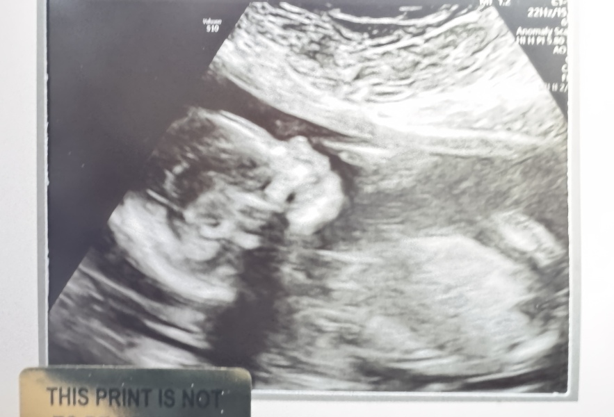 Halfway there chat thread🤰🏽