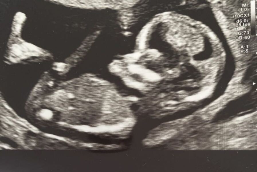 Any guesses on the gender of my little one 🩵🩷