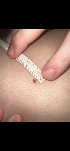 Moles