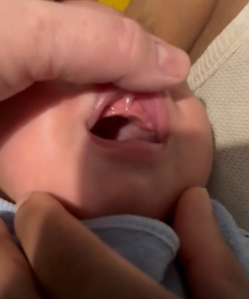 Do 9 week olds teethe !?