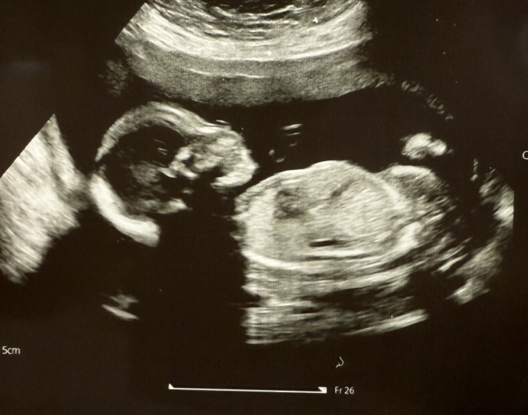 Guess the gender!