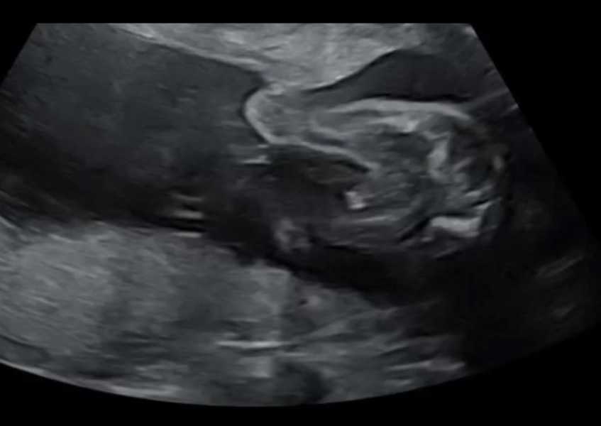 Halfway there chat thread🤰🏽
