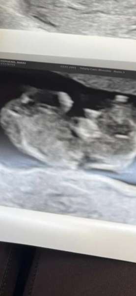 10 weeks 4 days