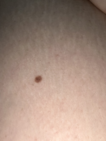 Mole