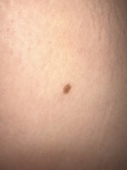 Mole