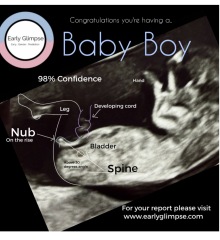 HELP!! Nub theory at 11 weeks 6 days