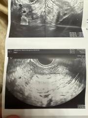 First US and doctor is not sure