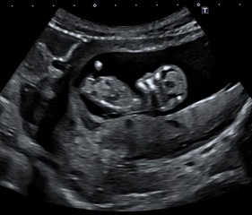 NUB THEORY: BOY OR GIRL?
