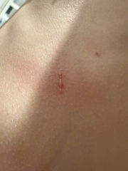 What’s this rash?