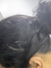 Hair loss. Please help!! Panic!