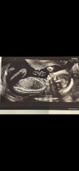 Any guesses on the gender of my little one 🩵🩷