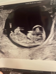 Boy or girl?!