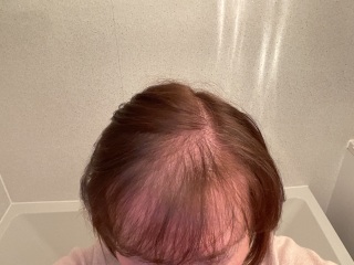 Mounjaro starters Nov ‘24 Thread 15 - the one where we wear ALL of the party dresses and are happily in ALL of the festive photos 🎄🥳