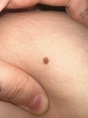 Moles