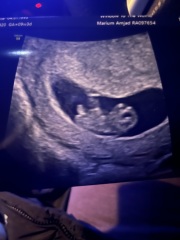 Gender guesses
