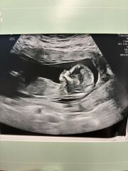 Boy or Girl 💙💕