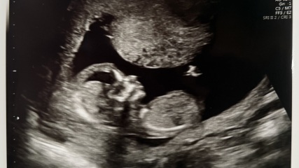 Nub theory gender prediction