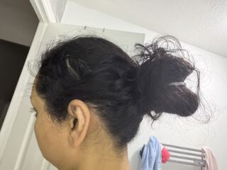 Hair loss. Please help!! Panic!