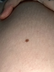 Moles