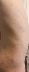 Mysterious red spots on toddler