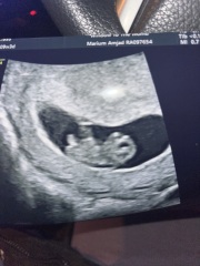 Gender guesses
