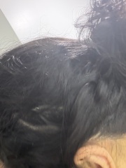 Hair loss. Please help!! Panic!
