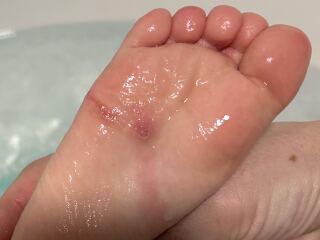 Odd marks/sores on DD feet?
