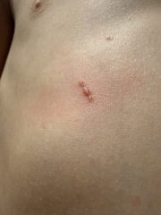 What’s this rash?