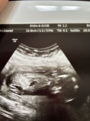Boy or girl guesses? 💕