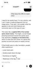 MRI image
