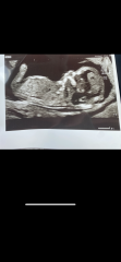 Any guesses on the gender of my little one 🩵🩷