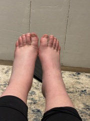 DVT? Third Trimester