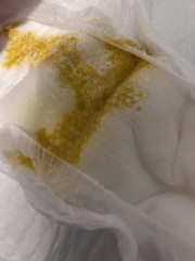 Baby poo worries ( warning baby poo pics )