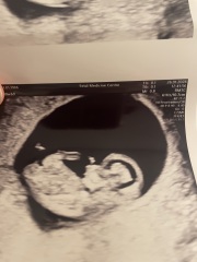 Guess the gender?