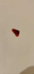 Is this a very early miscarriage?