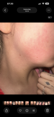 Moles