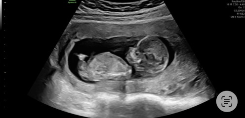 Scan predictions 💙💗