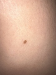 Moles