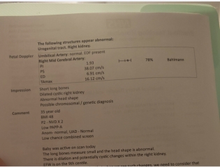 Scan at 36+1