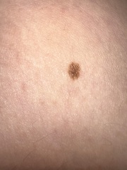 Moles