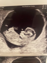 Guess the gender?