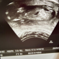 Boy or girl guesses? 💕