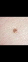 Moles