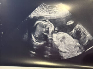 Boy or girl? Scan