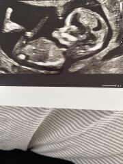 Any guesses on the gender of my little one 🩷🩵 I can’t seem to see a numb but not sure if its just me 🤔.