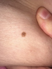 Moles