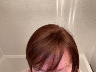 Mounjaro starters Nov ‘24 Thread 15 - the one where we wear ALL of the party dresses and are happily in ALL of the festive photos 🎄🥳