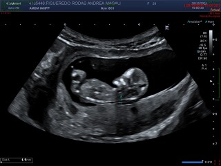 NUB THEORY: BOY OR GIRL?