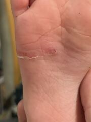 Odd marks/sores on DD feet?